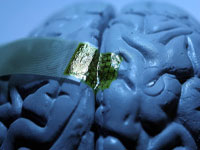 Implant cerebral cu matase, pentru leziunile maduvei si epilepsie