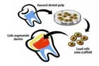 dental-stem-cells