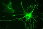 Astrocite programate sa devina celule nervoase