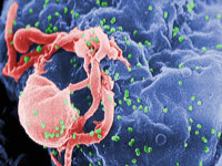 Tratament cu celule stem impotriva SIDA