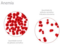 Celulele stem vindeca anemia aplastica