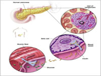 Diabetul tratat cu celule stem