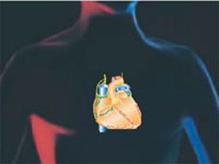 Pacienti cu infarct tratati cu celule stem