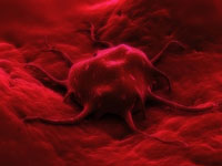 Leucemia vindecata cu ajutorul celulelor stem