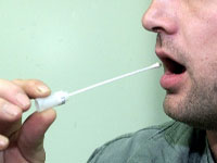 Test de saliva pentru depistarea cancerului