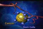 Tumori canceroase generate de iPSCs