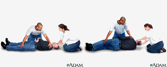 Primul ajutor: Imobilizarea pacientului cu leziune vertebrala
